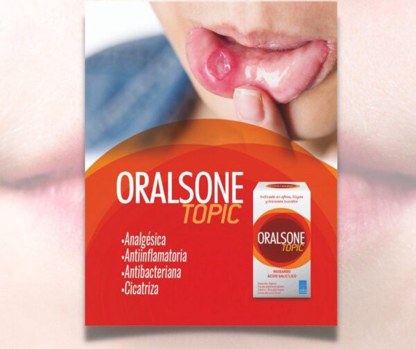 ORALSONE TOPIC (EXTRACTO HIDROALCOHOLICI DE RUIBARBO 5 G+ ACIDO SALICILICO 1G ).........VENTA X UNA UNIDAD...
